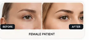 Female eyebrow shape illustrative result