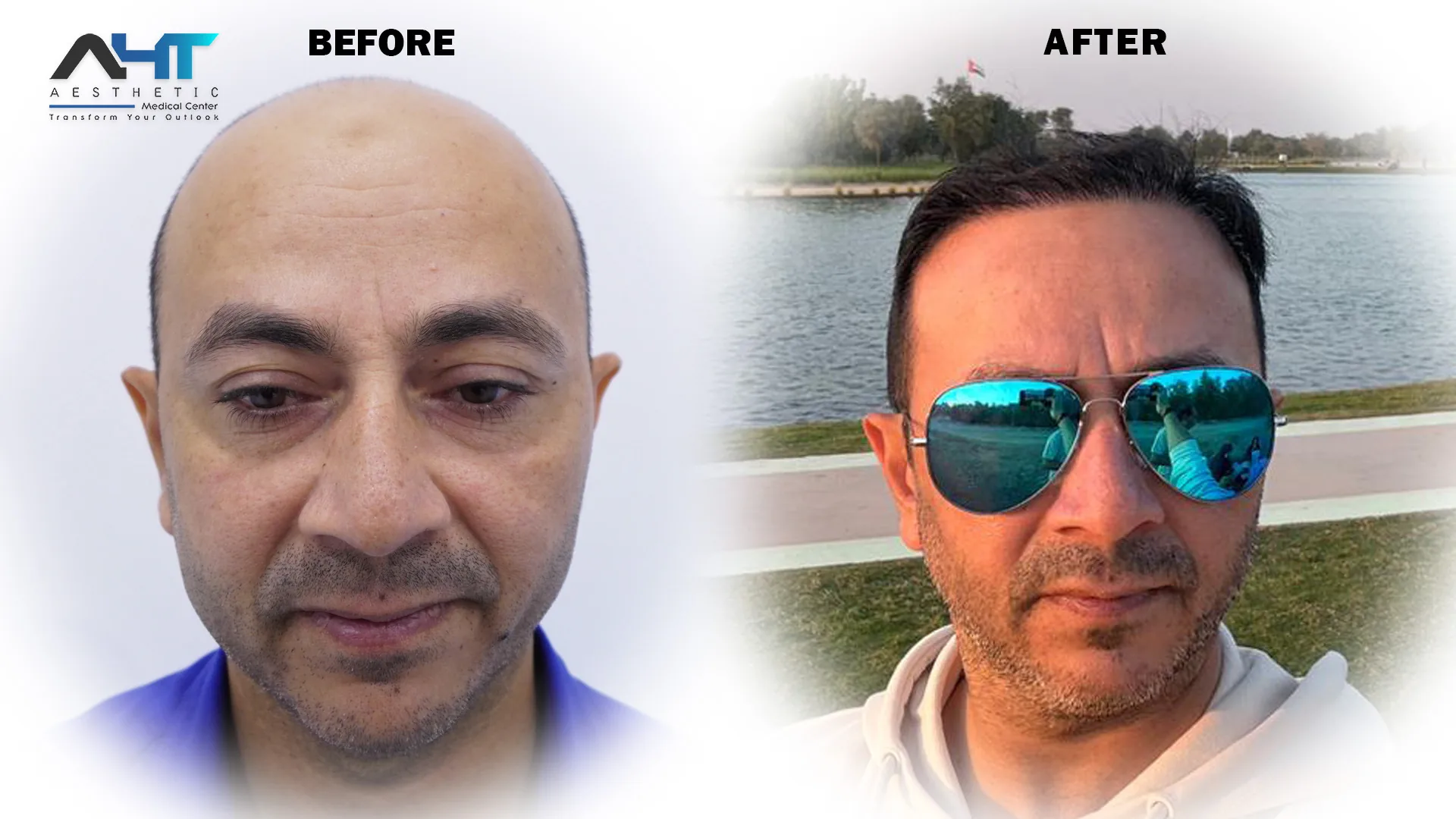 AHT Patient Result 8 before and after