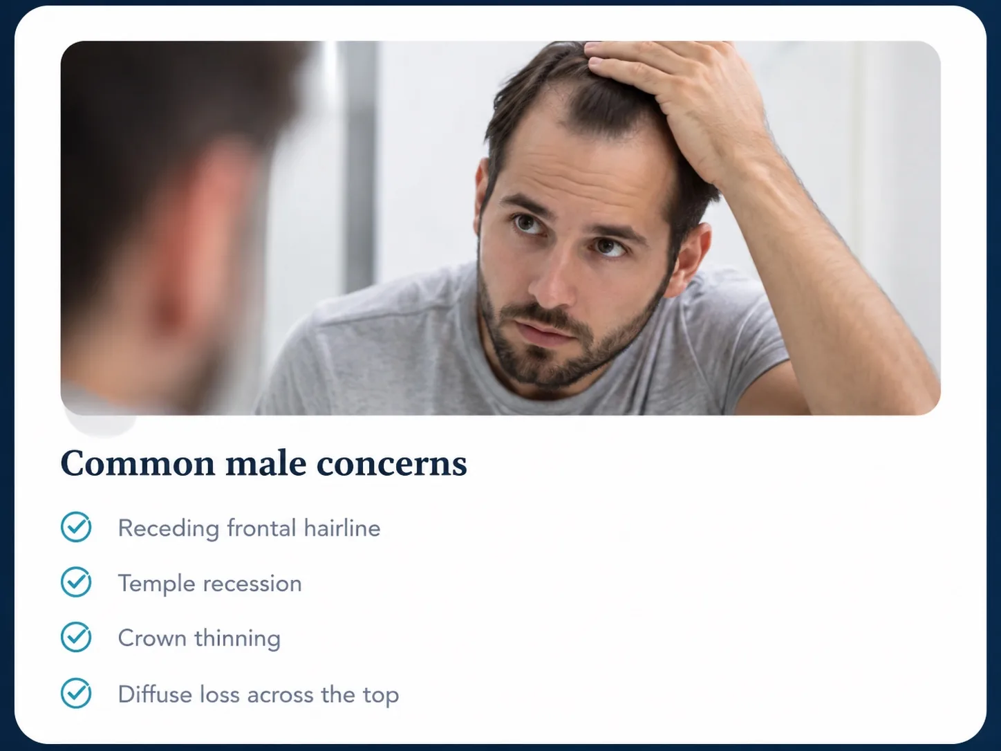 Man checking a receding hairline in a mirror