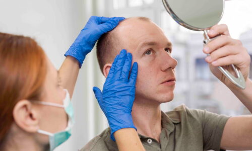 Can diabetics get hair transplant?