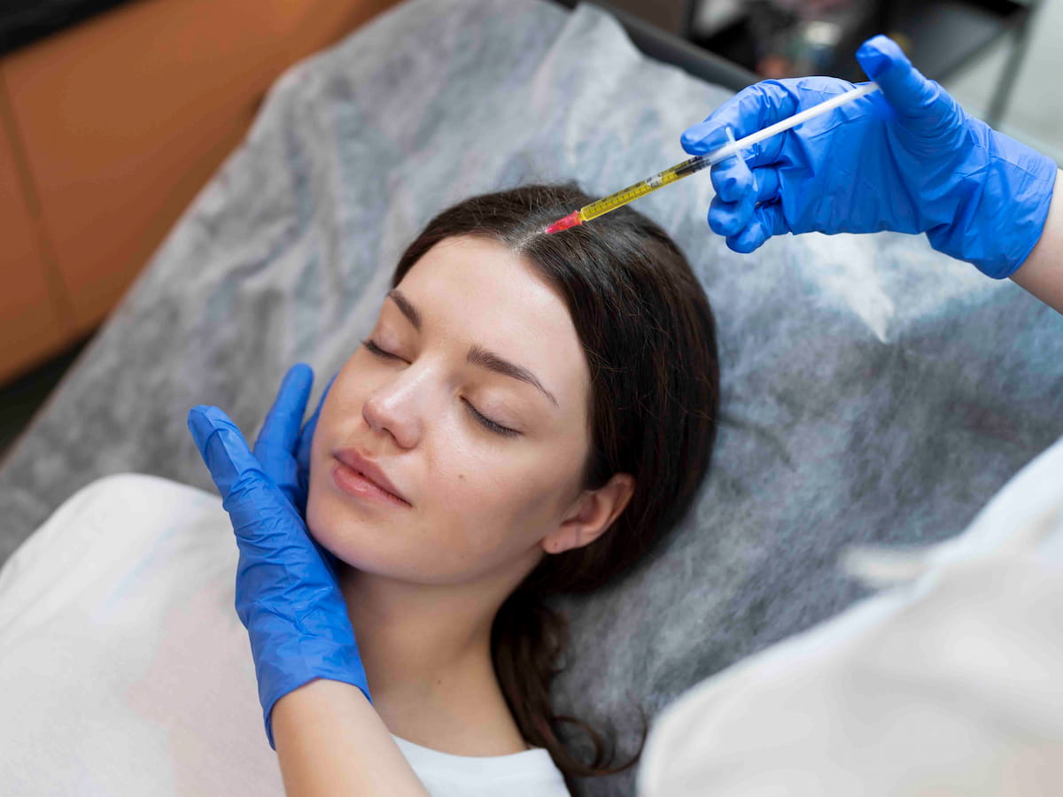 Female patient receiving FUE hair transplant injection on scalp