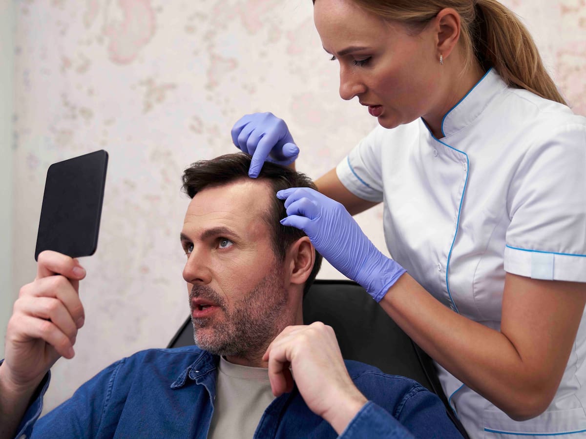 Man consulting with a hair specialist about when is the best time to get a hair transplant, while examining his scalp in a mirror.