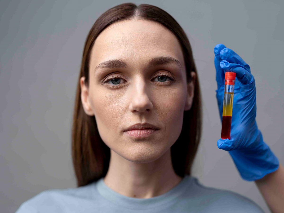 Woman looking forward as a gloved hand holds a vial of separated platelet-rich plasma (PRP), representing a step in the PRP therapy process.
