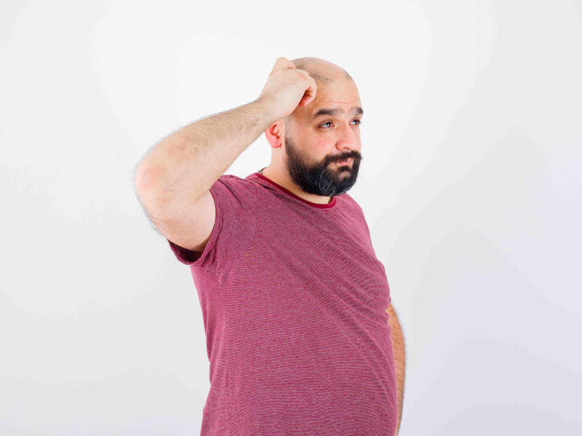Bald man in a red shirt scratching his head, appearing confused about which country is best for hair transplant options.