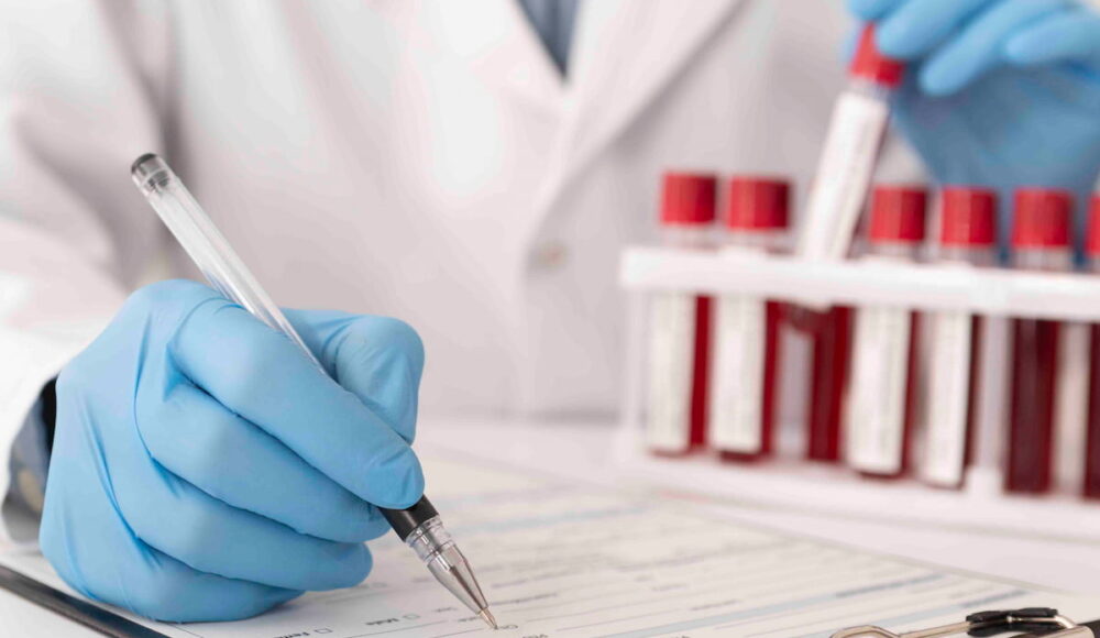 What Tests Are Done Before Hair Transplant?