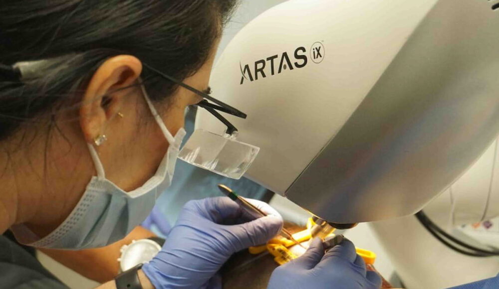 what is Artas Hair Transplant?