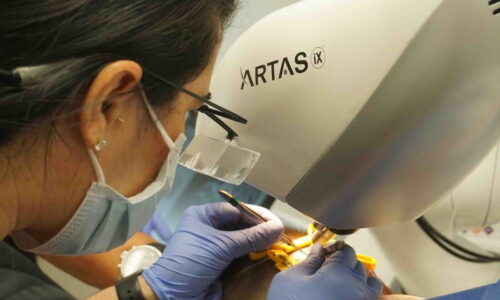 what is Artas Hair Transplant?