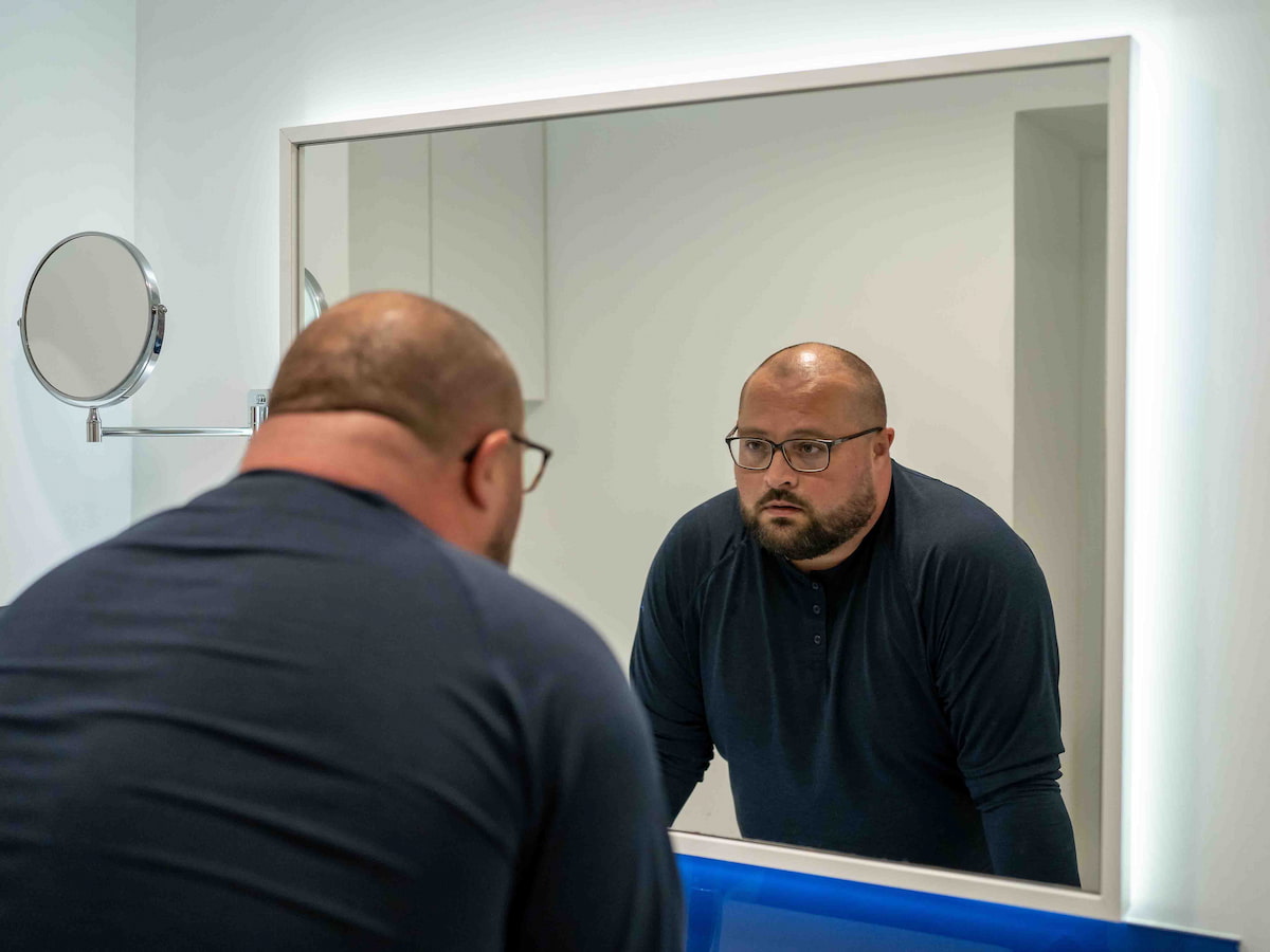 A man looking in the mirror, reflecting on hair loss and considering which season is best for hair transplant.