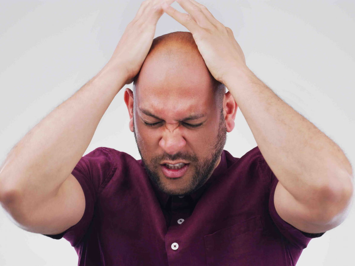 Man holding his scalp with discomfort, representing how long does pain last after hair transplant.
