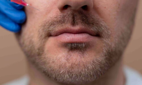 Mustache Hair Transplant