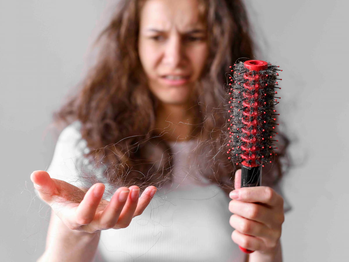 Woman holding hair strands and hairbrush showing hair loss problem, illustrating how to stop hair fall in Dubai
