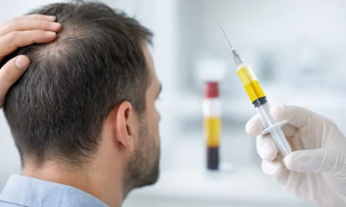 Does PRP Help Hair Shedding? What to Expect